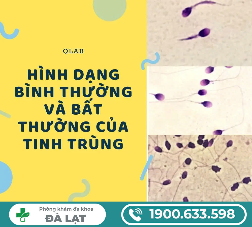 Hình ảnh minh họa